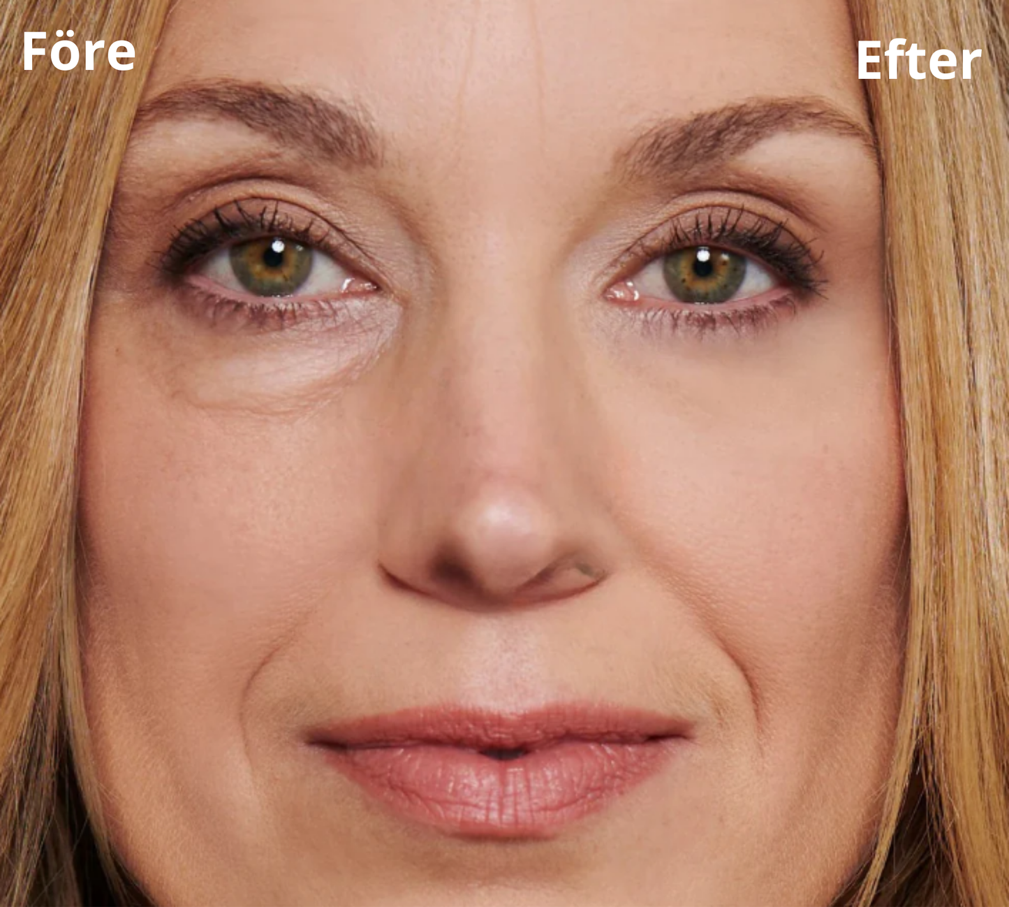 DermaTite™ Thomas Roth