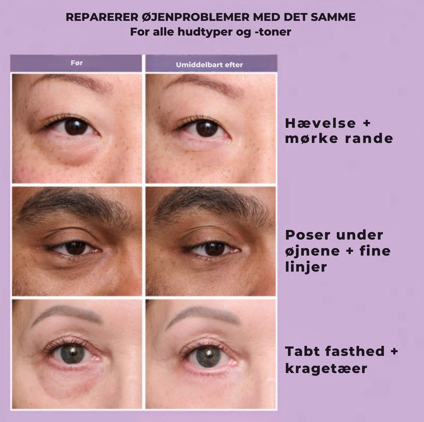 DermaTite™ Thomas Roth – Øjeblikkelig effekt mod poser og linjer