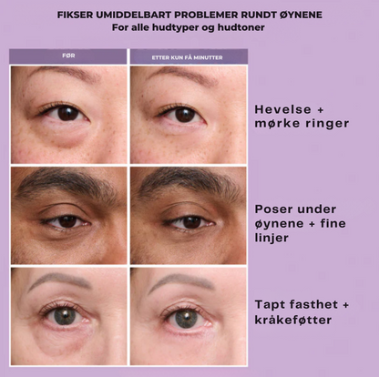 DermaTite™ Thomas Roth - Direkte effekt mot poser og linjer