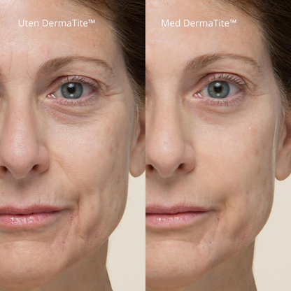 DermaTite™ Thomas Roth - Direkte effekt mot poser og linjer
